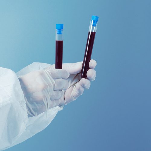 Colesterol HDL